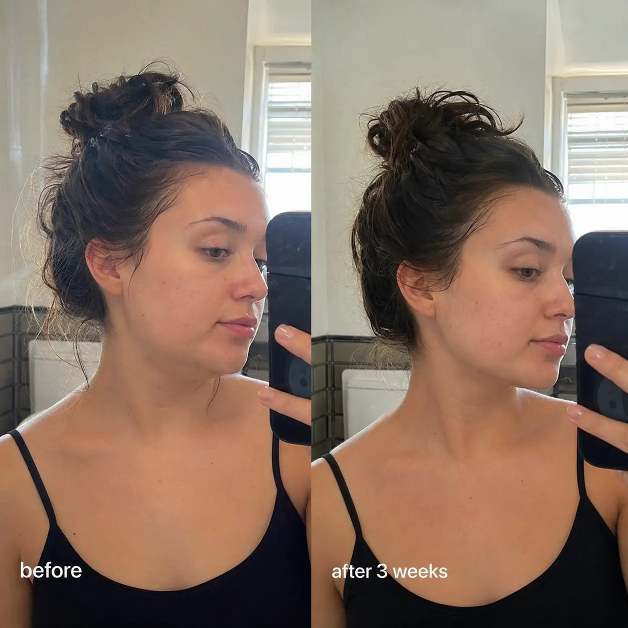 Flovise V-Lift Mask — Your at home jawline sculpting ritual