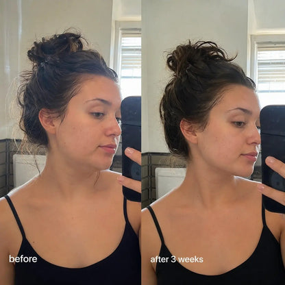Flovise V-Lift Mask — Your at home jawline sculpting ritual